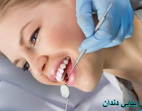 روش های رایج دندانپزشکی زیبایی 