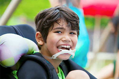 اختلال بلع چيست