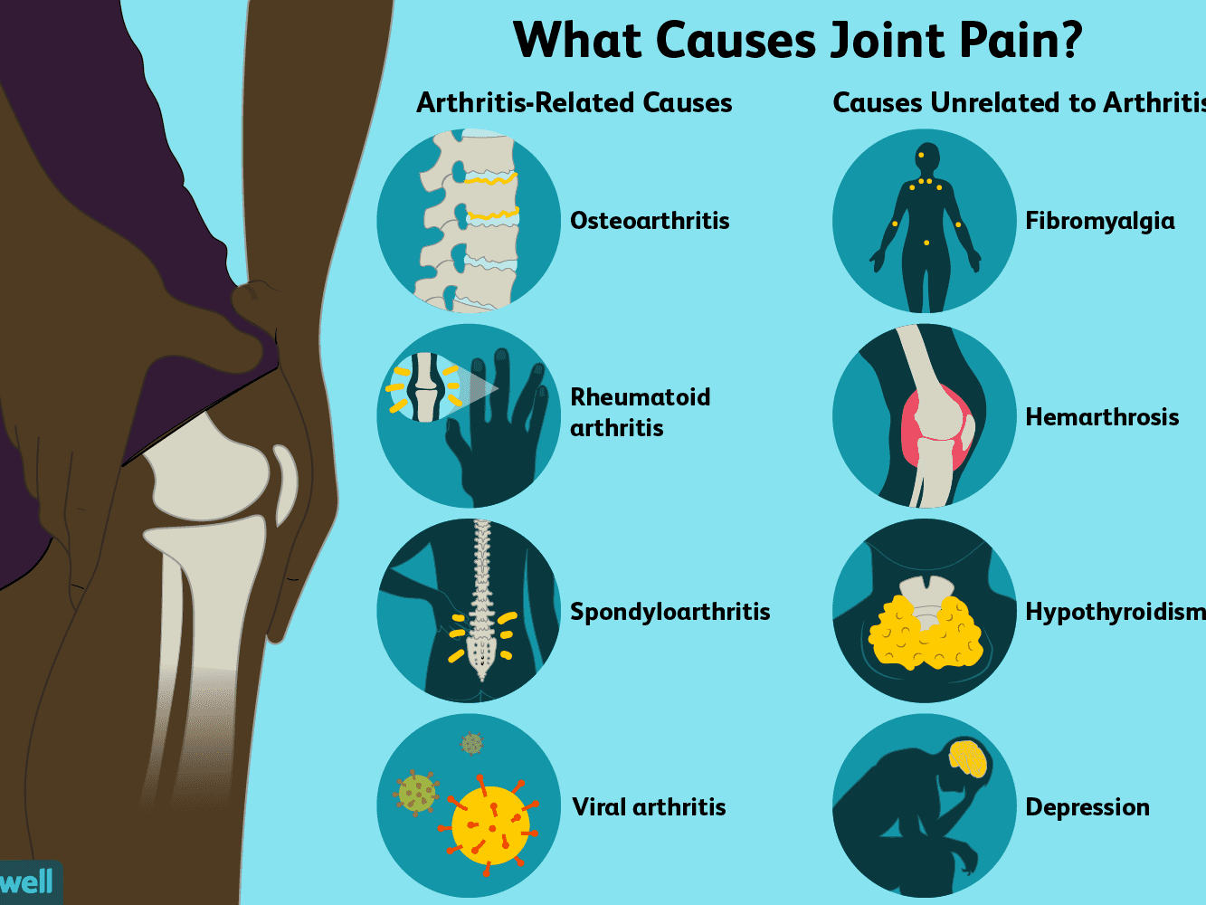 علت و درمان درد مفاصل چیست 