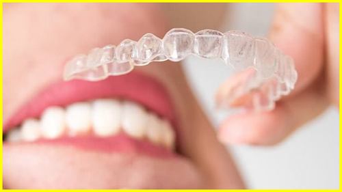 انواع محافظ دهان و دندان  را بهتر و کاملتر بشناسید